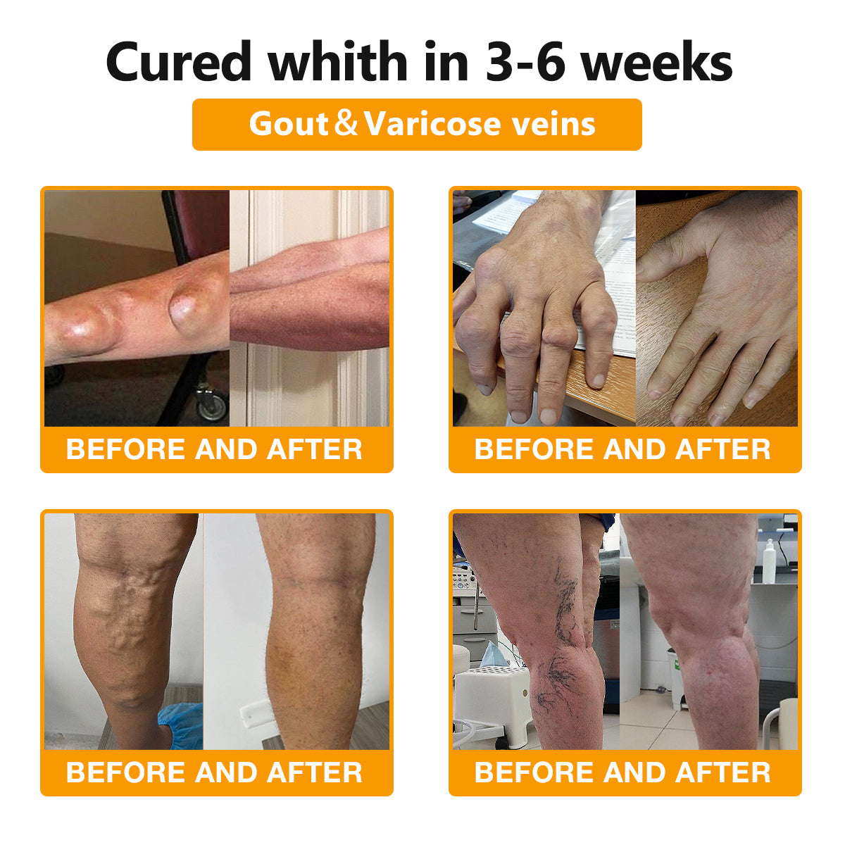 ArthroFree™ Bee-Venom Pain-Relief Bone Healing Cream(Specially for older adults & AAOS recommends)