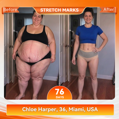 𝐎𝐟𝐟𝐢𝐜𝐢𝐚𝐥 𝐁𝐫𝐚𝐧𝐝 𝐒𝐭𝐨𝐫𝐞 👙 𝐏𝐀𝐔𝐑𝐀𝐉𝐔® 𝟐𝟎𝟐𝟔 𝐌𝐨𝐫𝐢𝐧𝐠𝐚 & 𝐁𝐞𝐫𝐛𝐞𝐫𝐢𝐧𝐞 𝟒-𝐈𝐧-𝟏 𝐌𝐢𝐜𝐫𝐨-𝐏𝐚𝐫𝐭𝐢𝐜𝐥𝐞 𝐒𝐜𝐮𝐥𝐩𝐭𝐢𝐧𝐠 & 𝐅𝐚𝐭-𝐁𝐮𝐫𝐧 𝐒𝐡𝐨𝐫𝐭𝐬