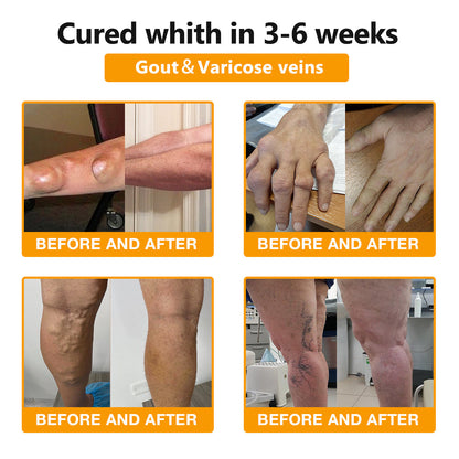 ArthroFree™ Bee-Venom Pain-Relief Bone Healing Cream(Specially for older adults & AAOS recommends)