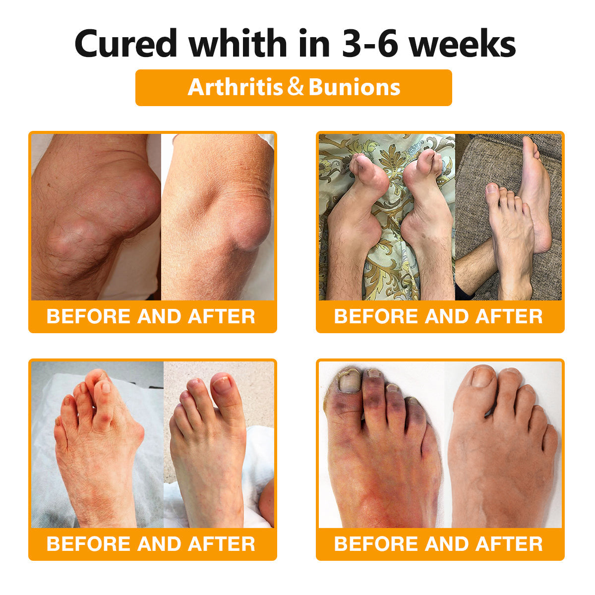 ArthroFree™ Bee-Venom Pain-Relief Bone Healing Cream(Specially for older adults & AAOS recommends)