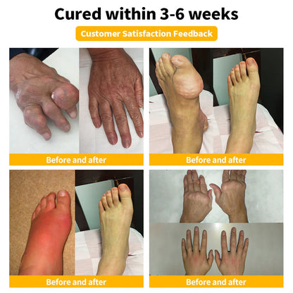 ArthroFree™ Bee-Venom Pain-Relief Bone Healing Cream(Specially for older adults & AAOS recommends)