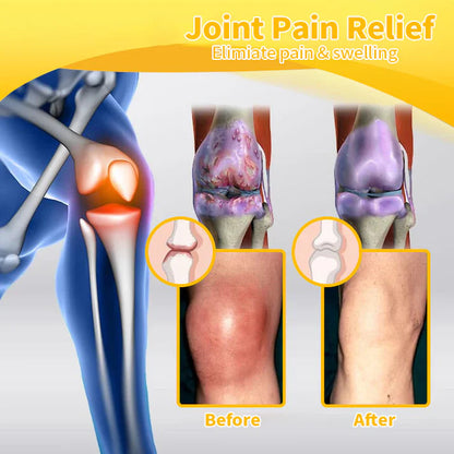 ArthroFree™ Bee-Venom Pain-Relief Bone Healing Cream(Specially for older adults & AAOS recommends)