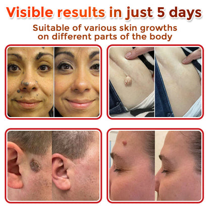 🎁 🎁 🎁Only 5 boxes left! We are offering an additional 50% discount! Get in shape and stay healthy! Take advantage of this opportunity now, because there won’t be another chance until next year.