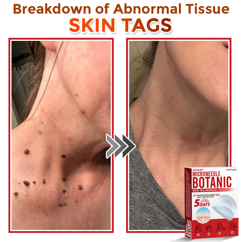 🎁 🎁 🎁Only 5 boxes left! We are offering an additional 50% discount! Get in shape and stay healthy! Take advantage of this opportunity now, because there won’t be another chance until next year.